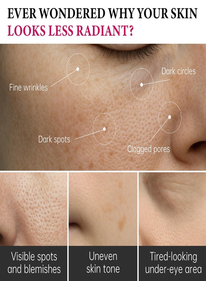 إيلهو كريم إيلهو أربوتين 7% + حمض الترانيكساميك 4%، 70000 جزء في المليون من الأربوتين و40000 جزء في المليون من حمض الترانيكساميك، مرطب، ينعم البشرة، يوحد لونها، يقلل البقع الداكنة والتصبغات، 1.76 أونصة سائلة (1) - Image 3